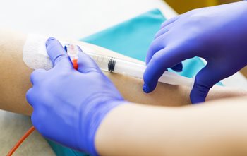 Infant Oro-Nasopharyngeal Suctioning